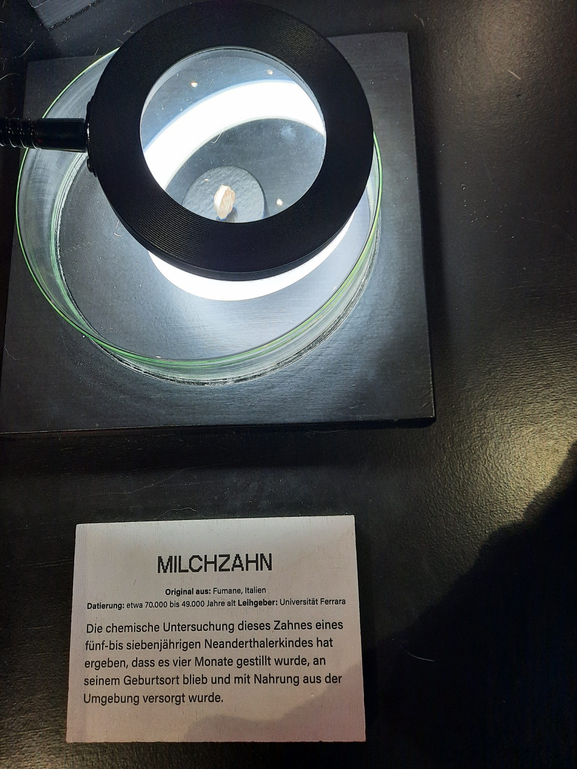 Miclchzahn Vitrine mit einem Milchzahn, von einer Lupe vergrößert